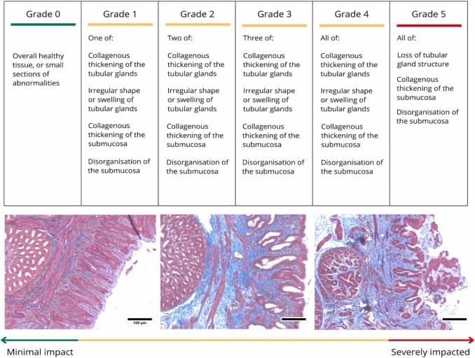 1 s2.0 S0304389423003722 gr1 - Plasticosis: Η πρώτη ασθένεια που προκαλείται από πλαστικά