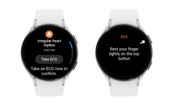 Η λειτουργία ειδοποίησης ακανόνιστου καρδιακού ρυθμού της Samsung για το Galaxy Watch λαμβάνει έγκριση από τον FDA
