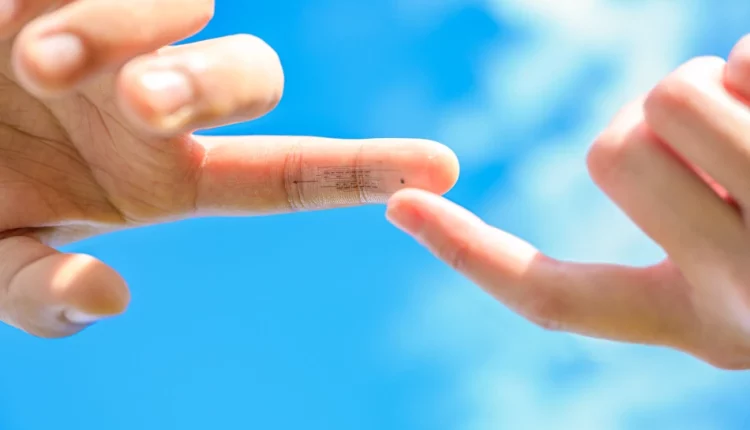 Το ηλεκτρονικό δέρμα μιμείται τον τρόπο με τον οποίο το ανθρώπινο δέρμα μπορεί να αισθάνεται το περιβάλλον - Επιστήμη