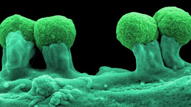 Προβιοτικά και βακτηριοφάγοι ιοί εναντίον ανθεκτικών μικροβίων