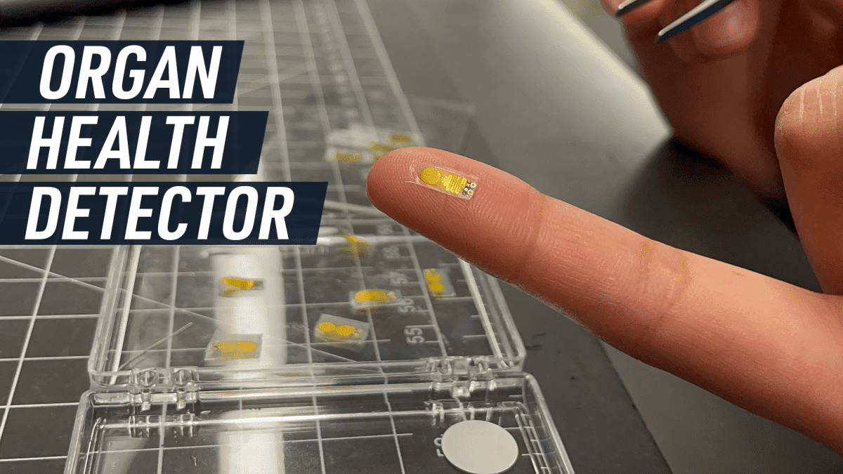 Το νέο εμφύτευμα μπορεί να παρακολουθεί την υγεία των μεταμοσχεύσεων οργάνων
