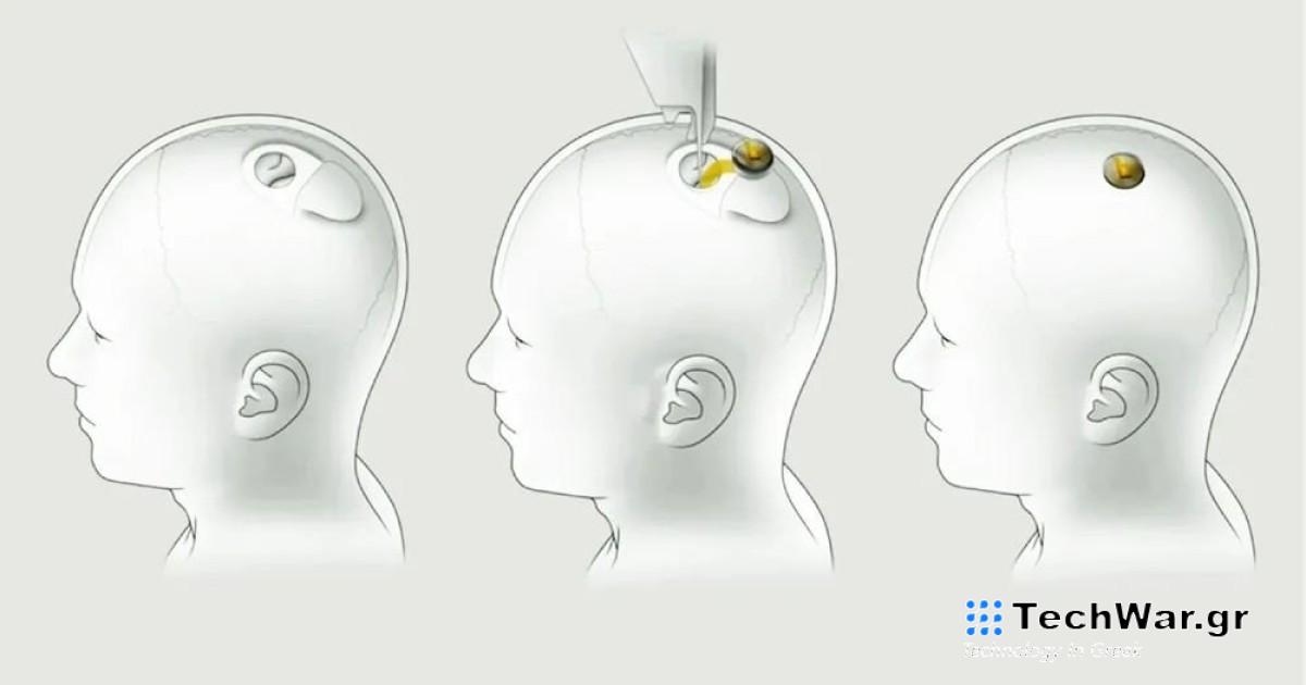Το πρώτο μικρό βήμα για την δημιουργία του «υπερανθρώπου» είναι γεγονός!