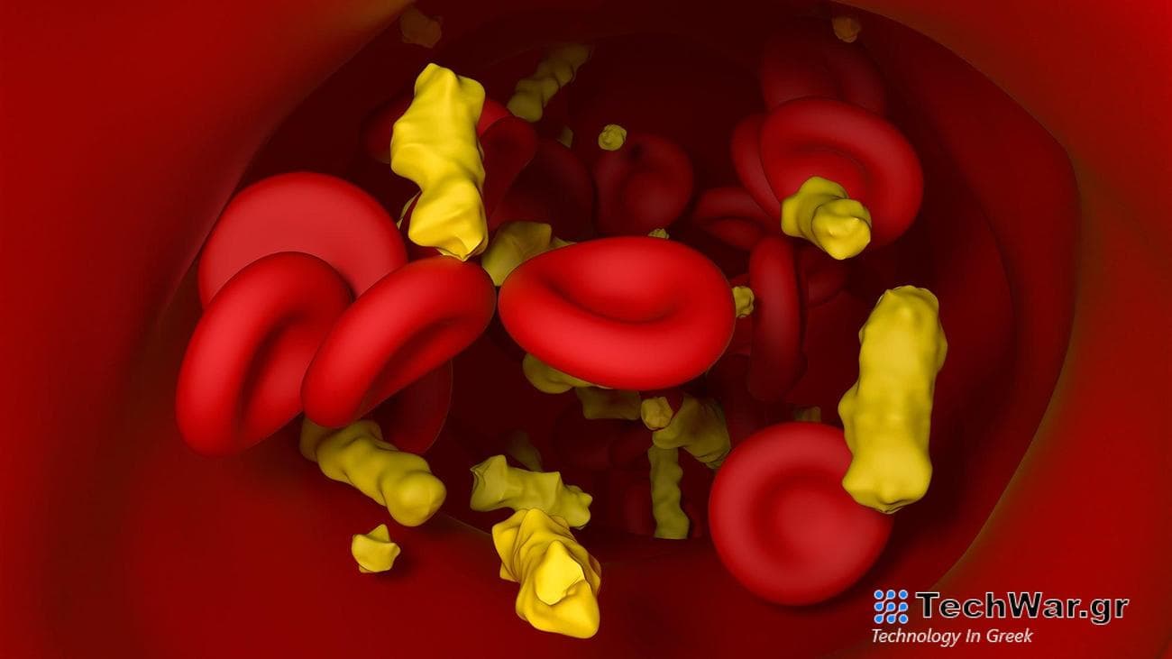 Cholesterol is a lipid, a fat-like substance. However, the cholesterol particles circulating in blood vessels come in a variety of forms.