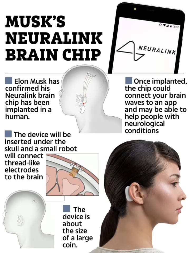 Neuralink τσιπ