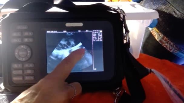 Ο υπέρηχος του σαλαχιού έδειξε ότι είναι έγκυος.