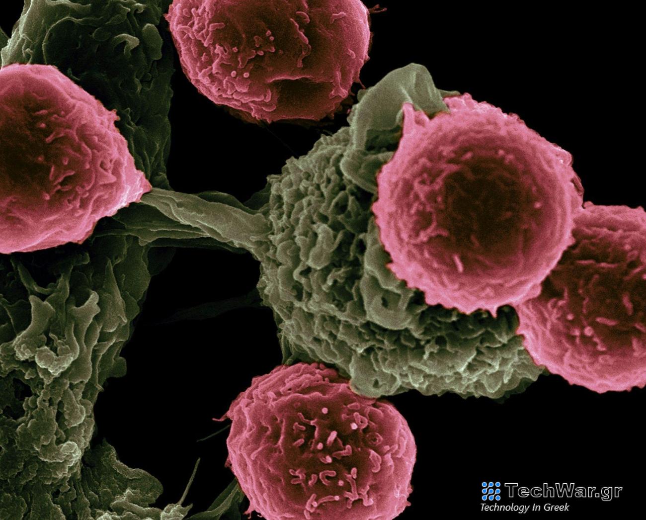 Θύμα του καρκίνου οι φτωχές χώρες της Ευρώπης - Οι ανισότητες κοστίζουν εκατομμύρια ζωές τον χρόνο