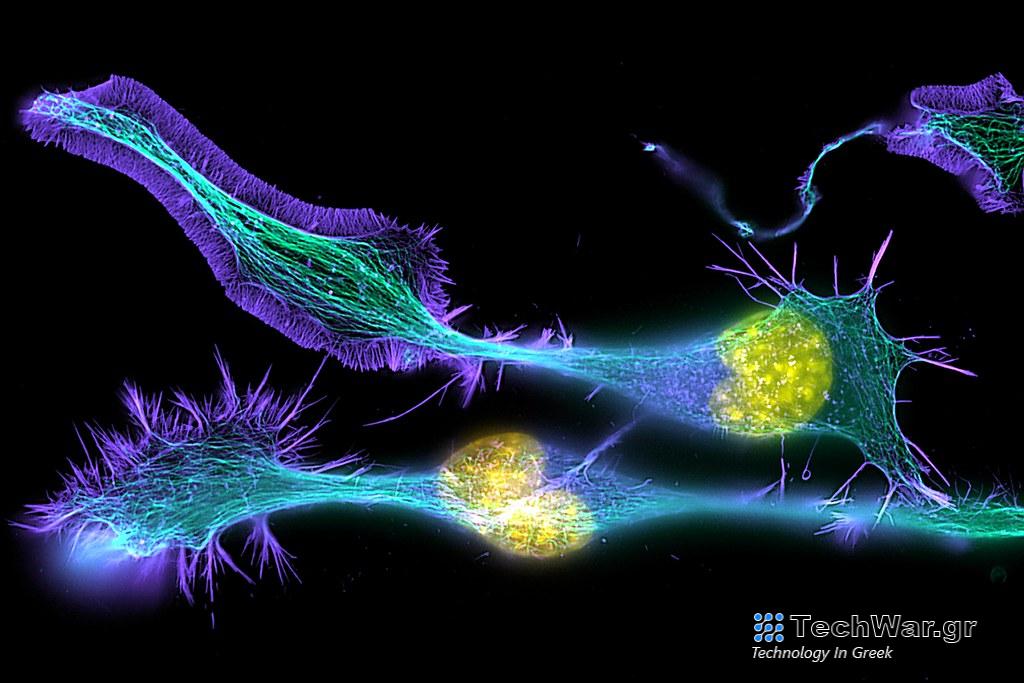 Τεχνητή νοημοσύνη: Μπορεί να επιταχύνει την ανακάλυψη φαρμάκων – Είναι όμως καλύτερη από τον άνθρωπο;
